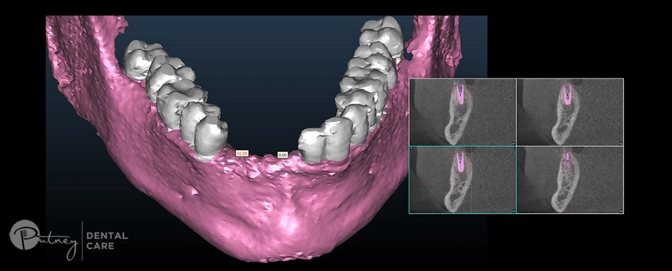 Cone Beam 3D Imaging