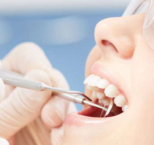 Wisdom Teeth Removal Sydney
