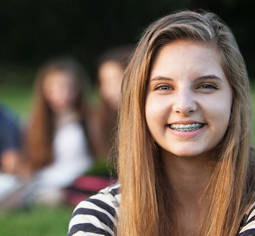 Whitening with Braces