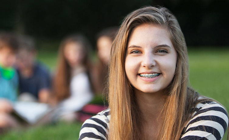 Whitening with Braces