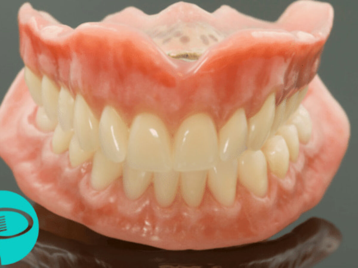 White Gums: Causes & Treatments - Putney Dental Care