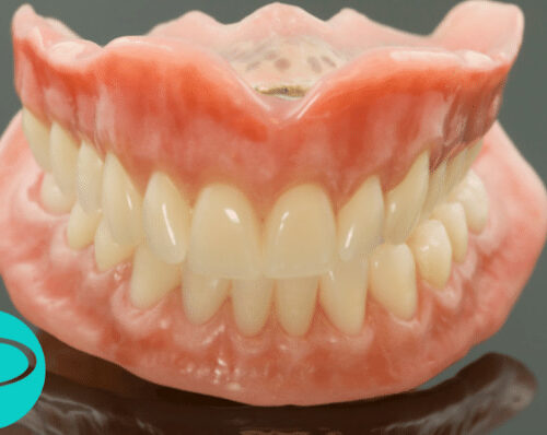 Dentures with Putney Dental Care