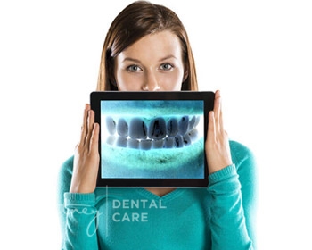 Dental X-Ray Examinations